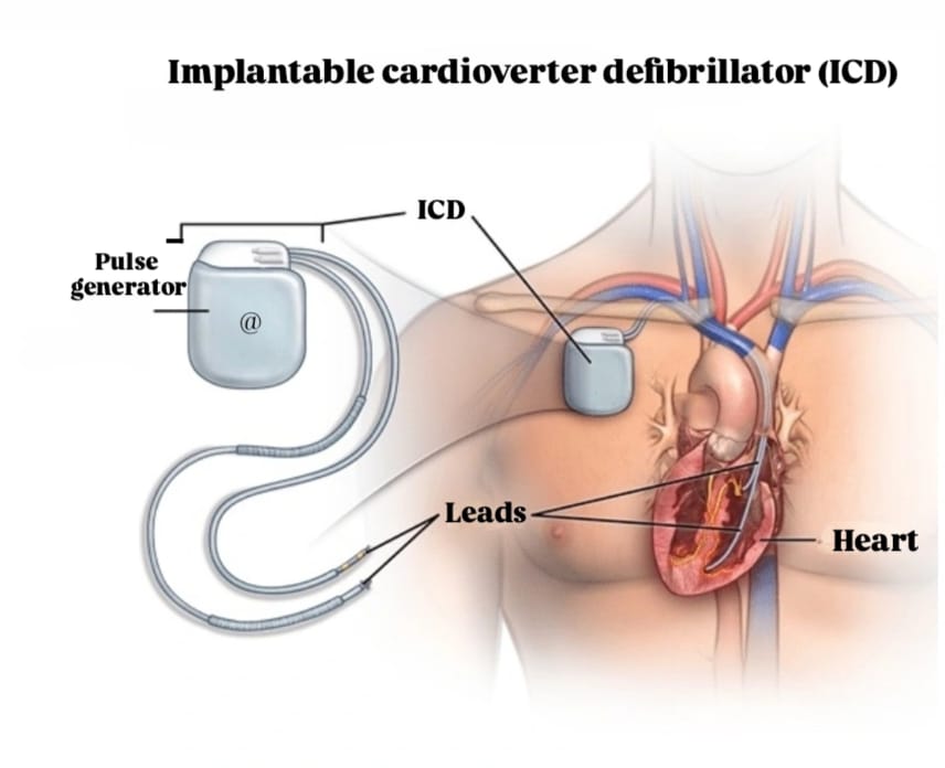 Defibrillator