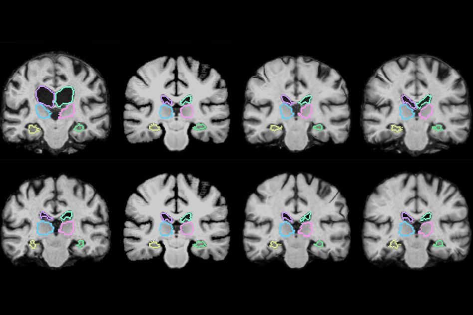 AI in Medical Equipment