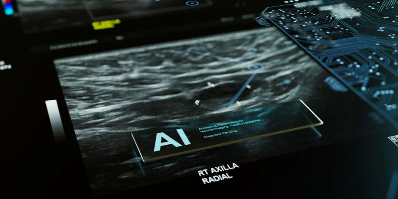 AI Breast Cancer Detection